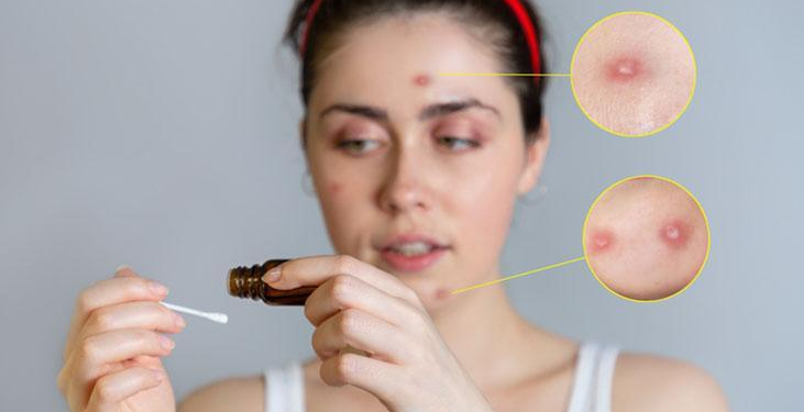 Cilt lekelerine ameliyatsız çözüm! Daha dolgun görünüyor, kırışıklıktan eser yok