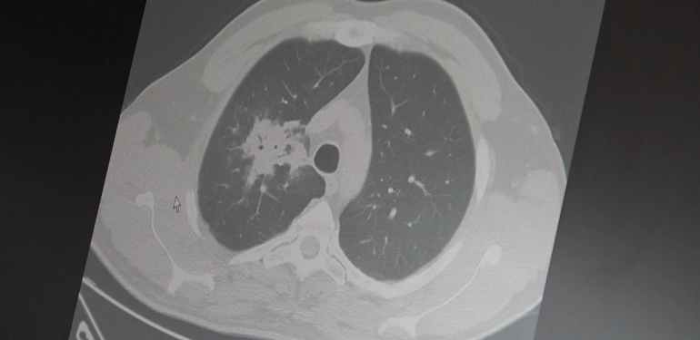 Elektronik sigara için “süre doldu”