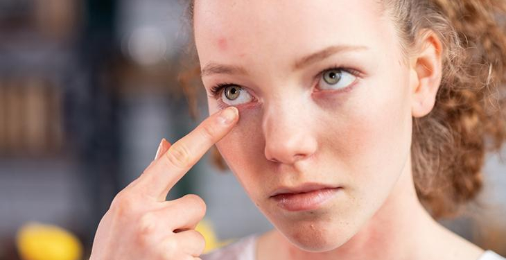 Mevsimsel değişim cildinizi tehdit etmesin! Uzmanlardan bahar uyarısı