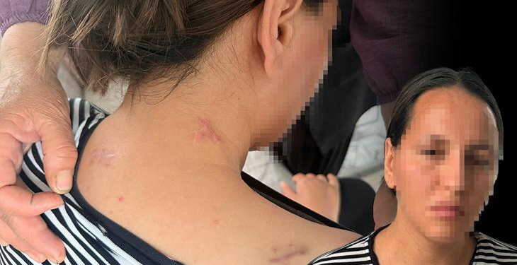 Ölü numarası yaparak kurtuldu: Geceleri uyuyamıyorum