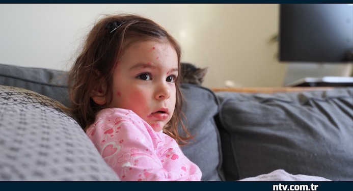 Unutulan hastalık geri mi dönüyor? İstanbul’da vaka sayılarında artış